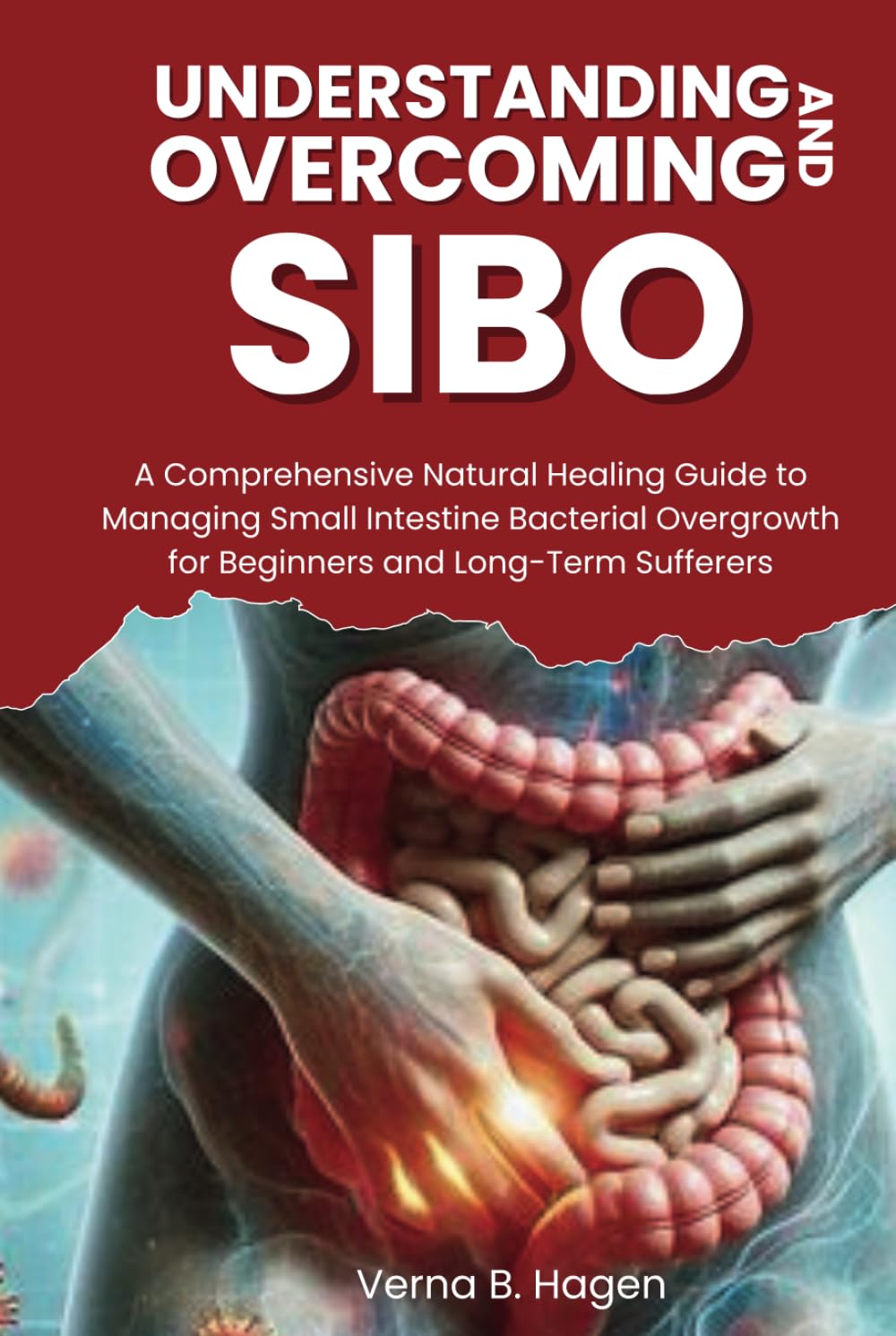 Understanding and Overcoming SIBO: A Comprehensive Natural Healing Guide to Managing Small Intestine Bacterial Overgrowth for Beginners and Long-Term ... Cause Revolution: Your Path to True Health)