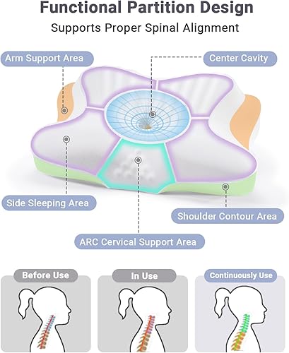 Miniatura 3 de Almohada cervical para dolor de cuello y hombros, almohada ortopédica de contorno ergonómico con fundas de almohada refrescantes y palos de apoyo,