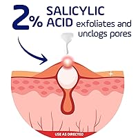 Vista 5 de Asepxia 2% Salicylic Acid Acne Spot Treatment Cream Drying Formula Targets Acne, Clears & Prevents Blemishes, Reduces Redness, Penetrates Pores