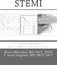 Stemi: 3-Minute Diagnosis, 90-Minute Reperfusion : Saving Time, Saves Lives