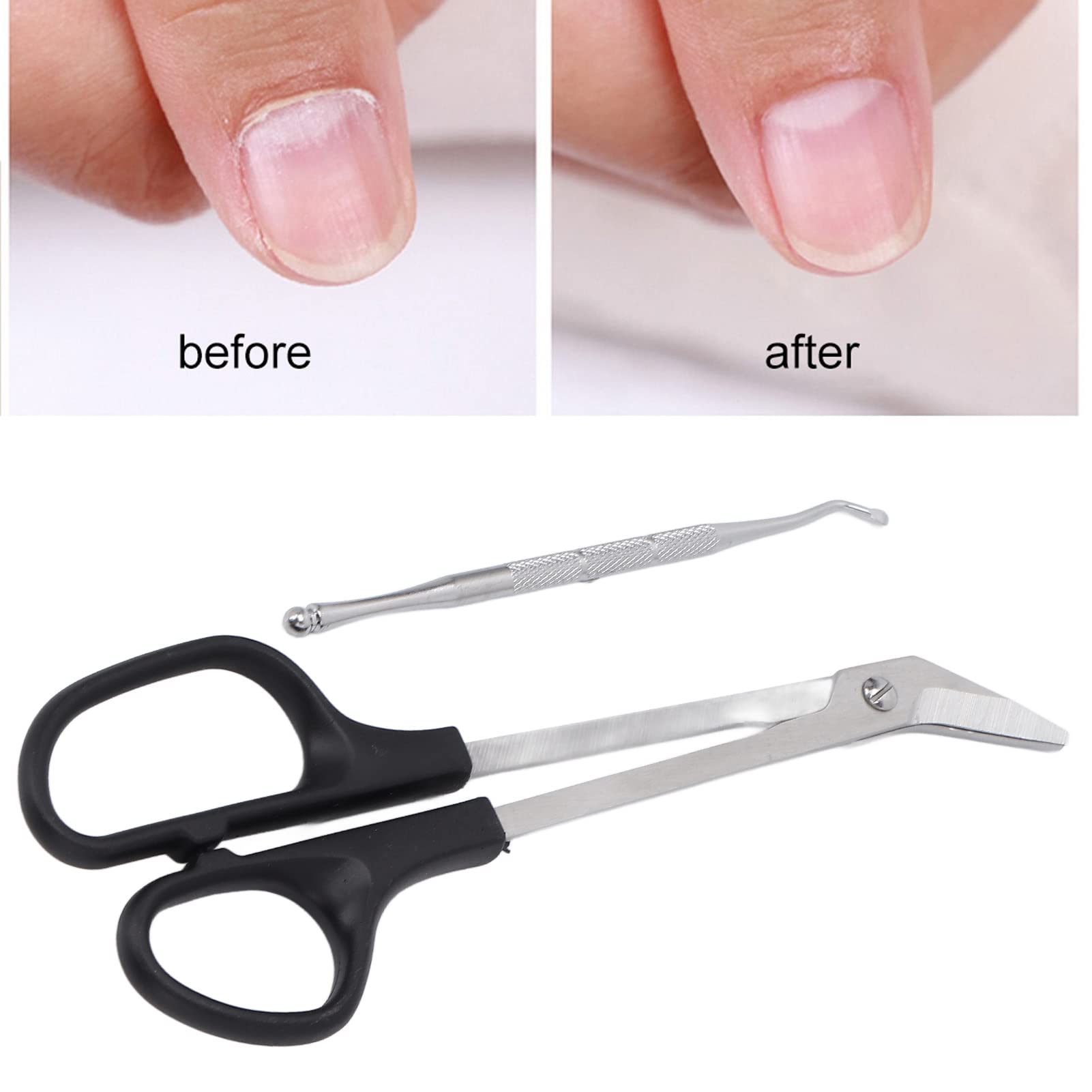 Ciseaux à Ongles à Longue Portée, Ciseaux à Ongles à Long Manche, Coupe-ongles Ergonomique Au Design Unique Avec Coupe-ongles Pour Adultes Et Personnes âgées