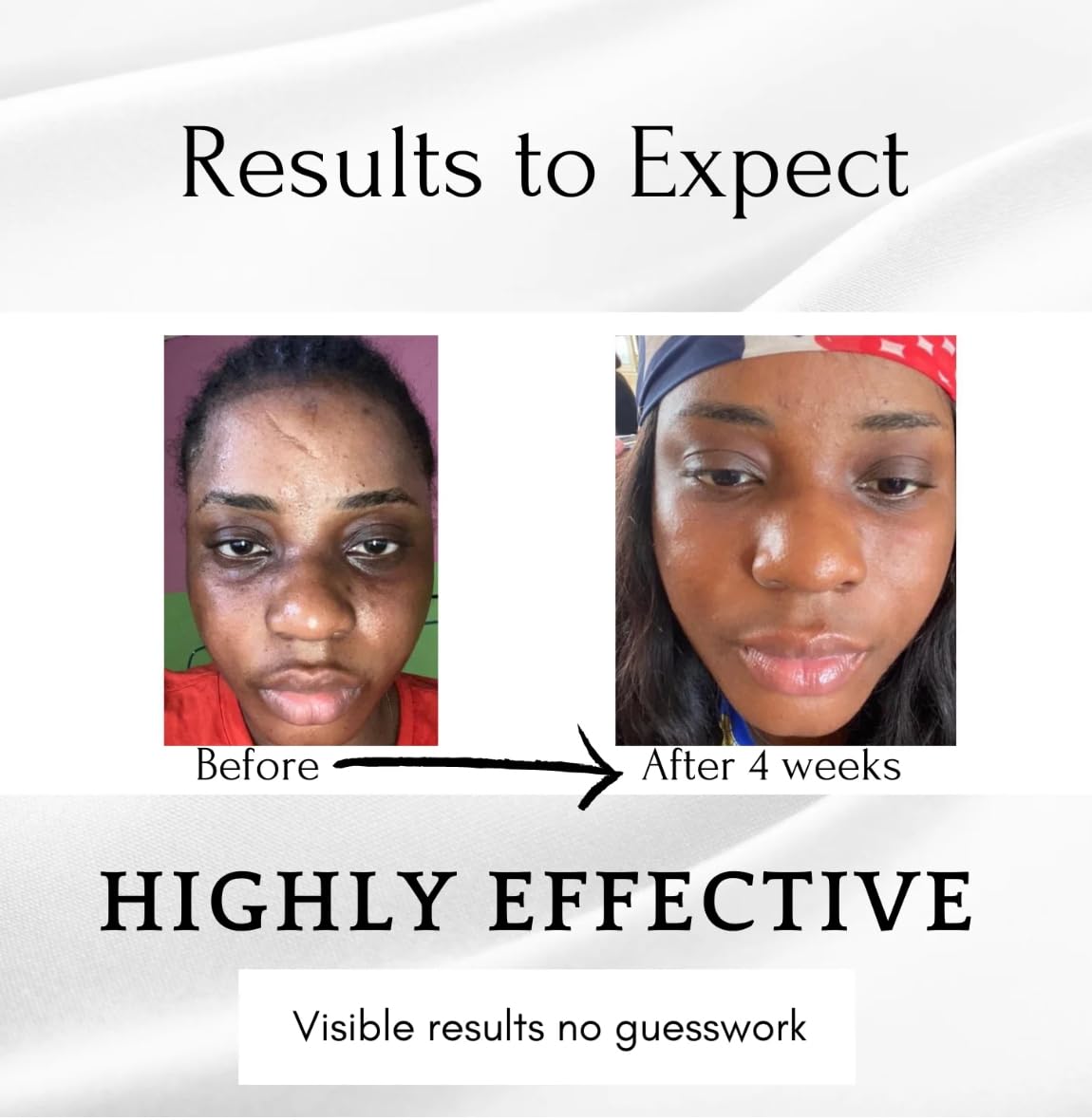 Dark circles, Dark Under Eye Serum, Dark Circles Eraser serum 0.5 FL OZ