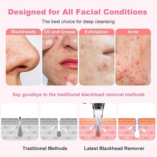 Miniatura 5 de Aspiradora de poros para eliminar puntos negros, limpiador facial de poros, 5 potencias de succión, 5 sondas, kit de aspiradora recargable por USB