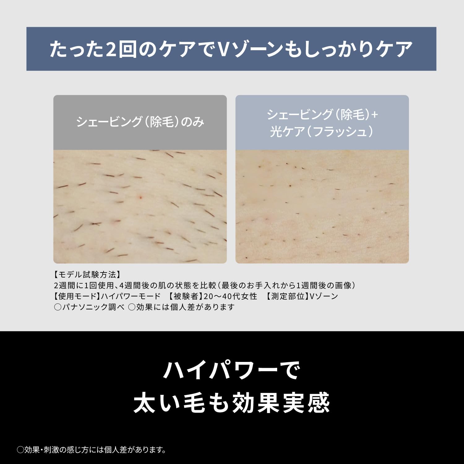Amazon | パナソニック 脱毛器 光美容器 光エステ スムースエピ 美肌