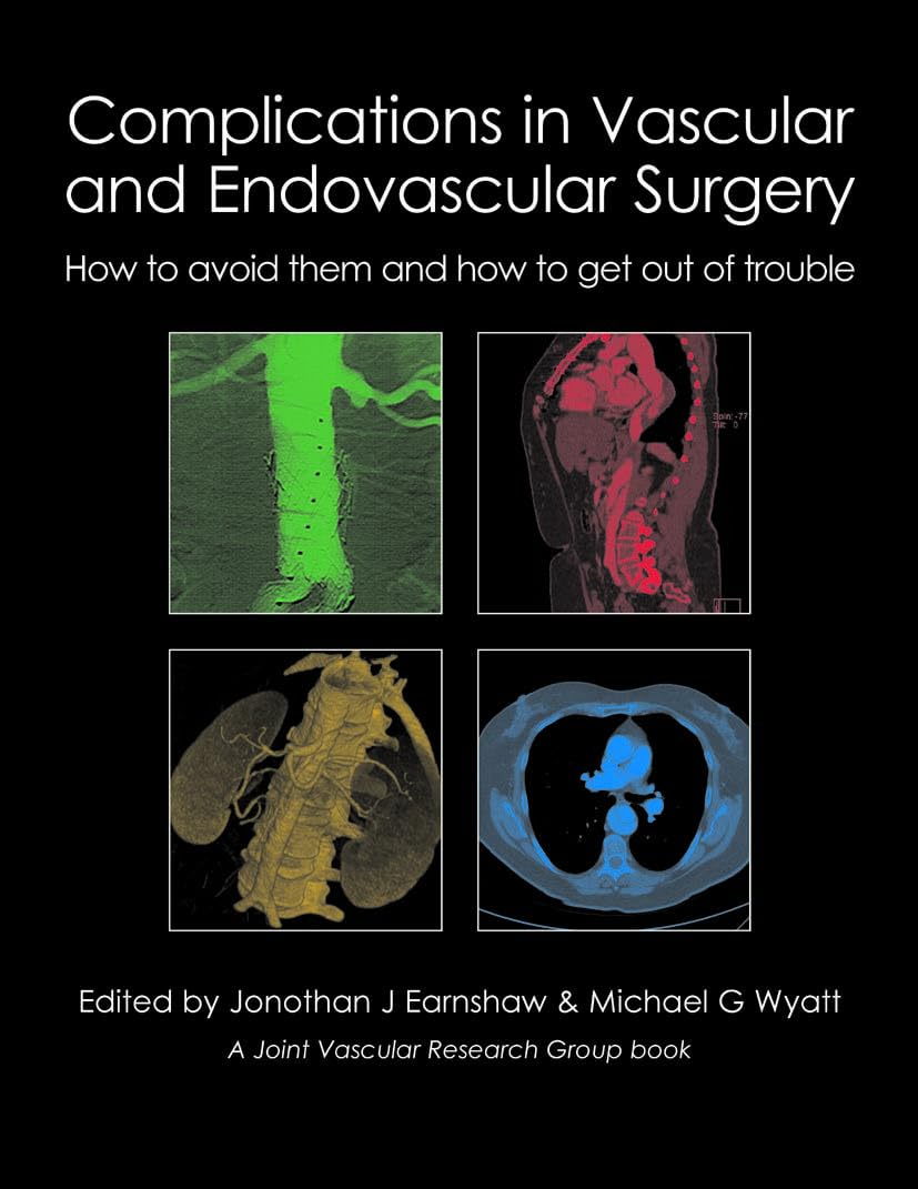 Complications in Vascular and Endovascular Surgery (Hardback Book)
