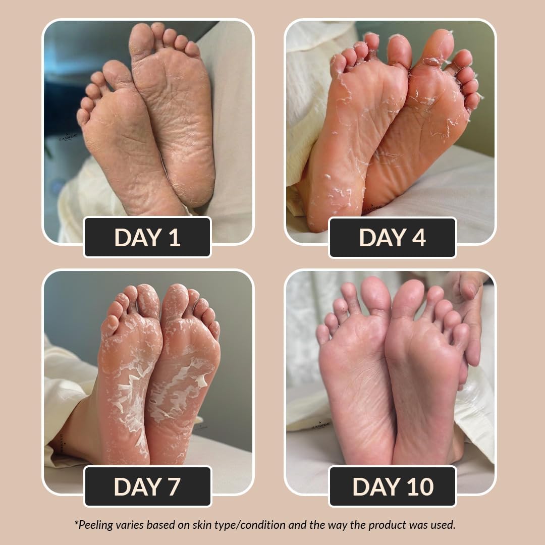 LuxaDerme Korean Foot Peeling Mask with Glycolic, Salicylic & Lactic Acids | Peeling & Exfoliating Treatment for Dry Skin & Callus Removal | Baby-Soft Feet 1