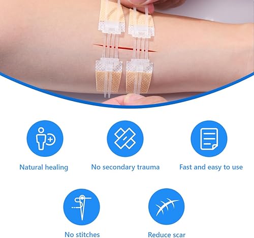 Miniatura 2 de Cierres de heridas de emergencia 3 vendajes de mariposa, vendajes adhesivos, suturas de puntada, reparación de laceración con cremallera sin