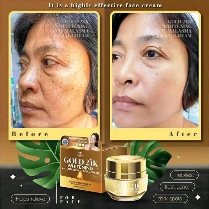 Gold 24k Whitening Anti-Melasma Facial Cream with anti- melasma soap 15g