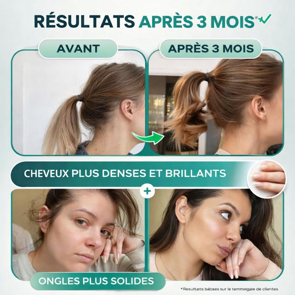 Circles GROW Integratore Capelli e Unghie Donna Biotina Selenio Ferro Serenoa Repens Equiseto Silice Vitamine B3 B5 B6, Senza Zuccheri Aggiunti, 30 Capsule Vegan Made in France