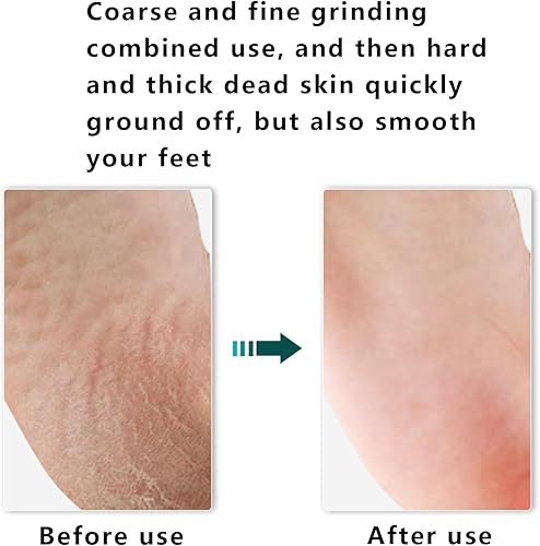Miniatura 4 de Lima de pie y removedor de callos.La mejor herramienta de superficie de pedicura para el cuidado de los pies para eliminar la piel dura. Se puede