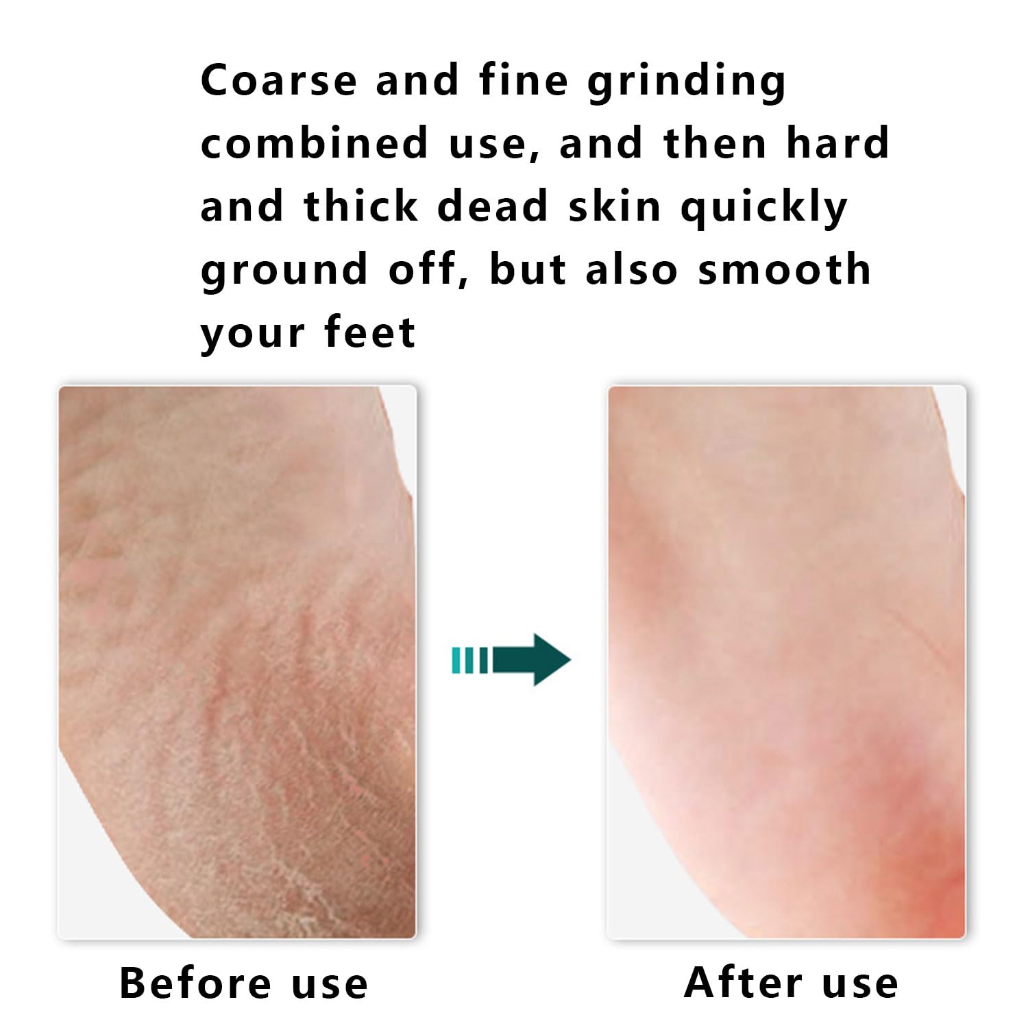 Lima de pies y removedor de callos. La mejor herramienta de superficie de pedicura para el cuidado de los pies para eliminar la piel dura. Se puede utilizar tanto en pies húmedos como secos, lima de