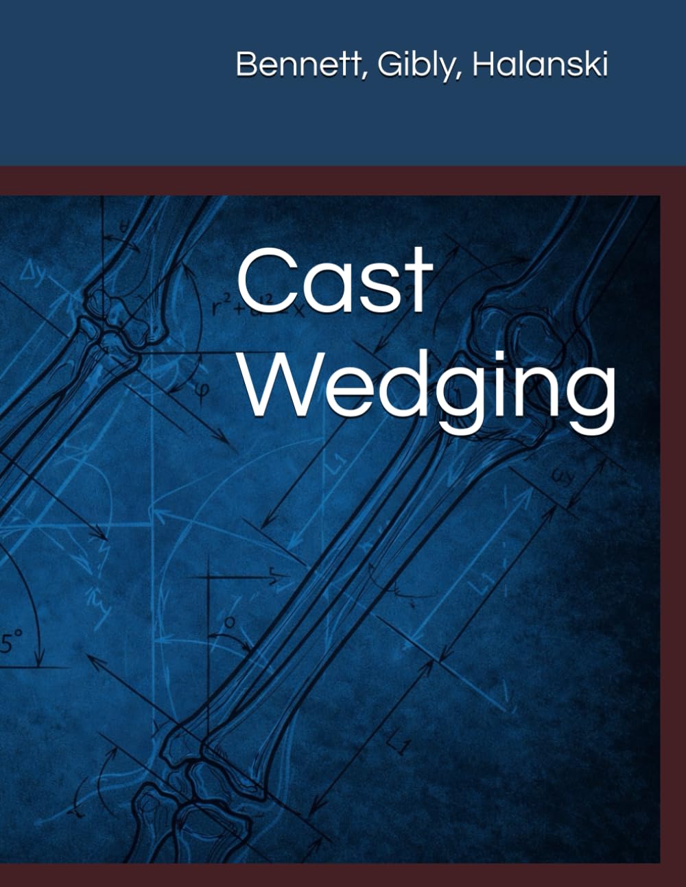 Cast Wedging: Techniques for maintaining optimal alignment in nonoperative fracture care. (Intraoperative and Perioperative Pediatric Orthopaedic Planning)