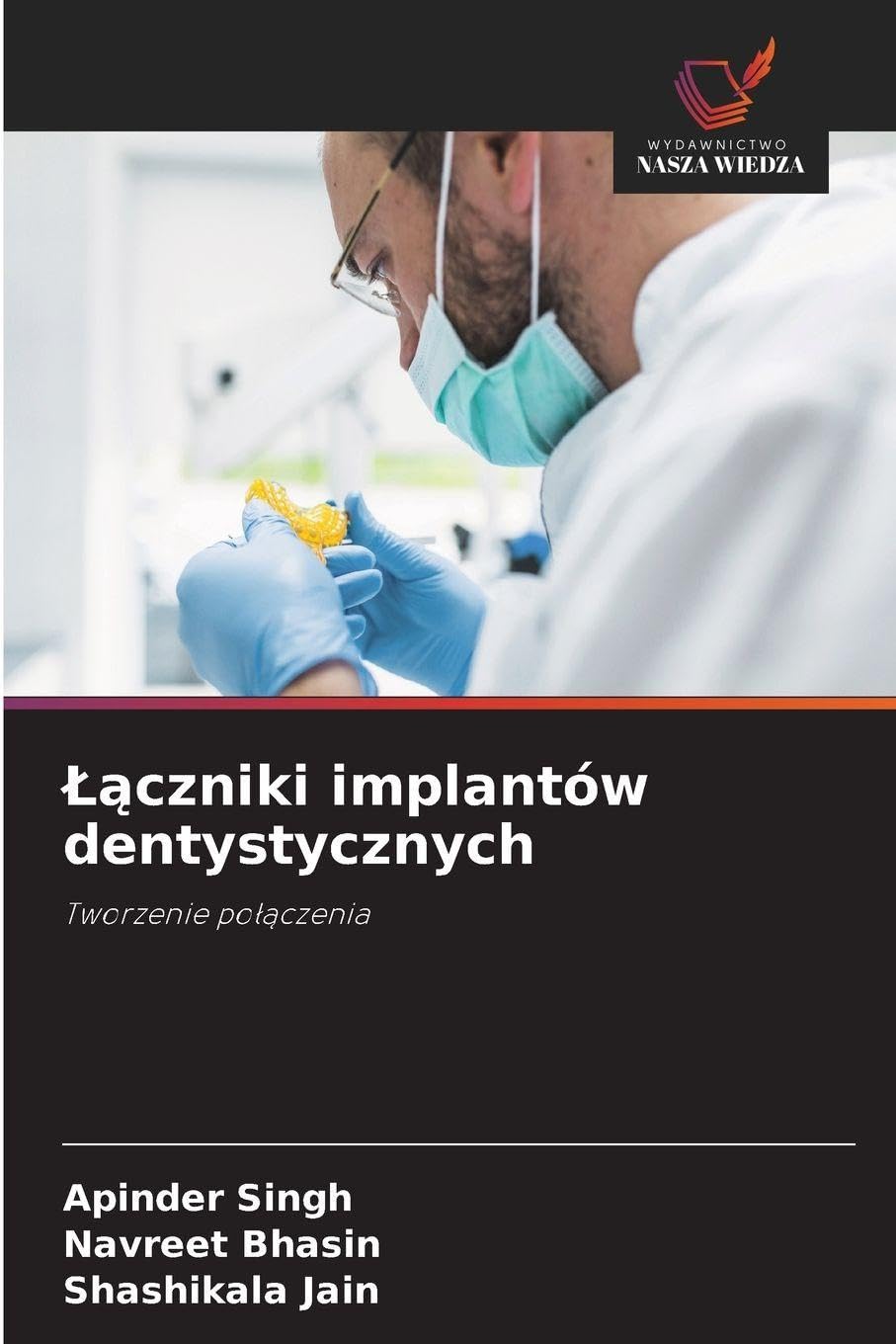 ¿¿czniki implantów dentystycznych: Tworzenie po¿¿czenia