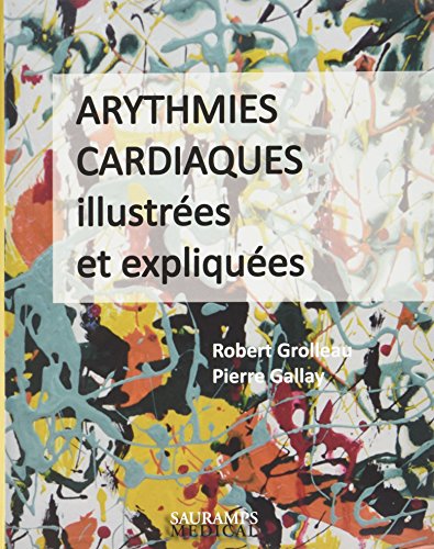 Arythmies cardiaques illustrées et expliquées