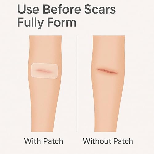 Miniatura 3 de Hojas transparentes para cicatrices  10 piezas  Parches para la piel para la cara y el cuerpo  Uso antes de que se formen cicatrices completamente