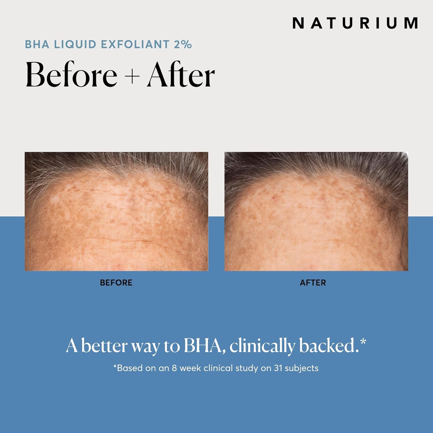 Naturium BHA Liquid Exfoliant 2%, Leave-on Face & Skin Care Pore Exfoliant, with Salicylic Acid & Bioactive Fruit Acids - Image 4