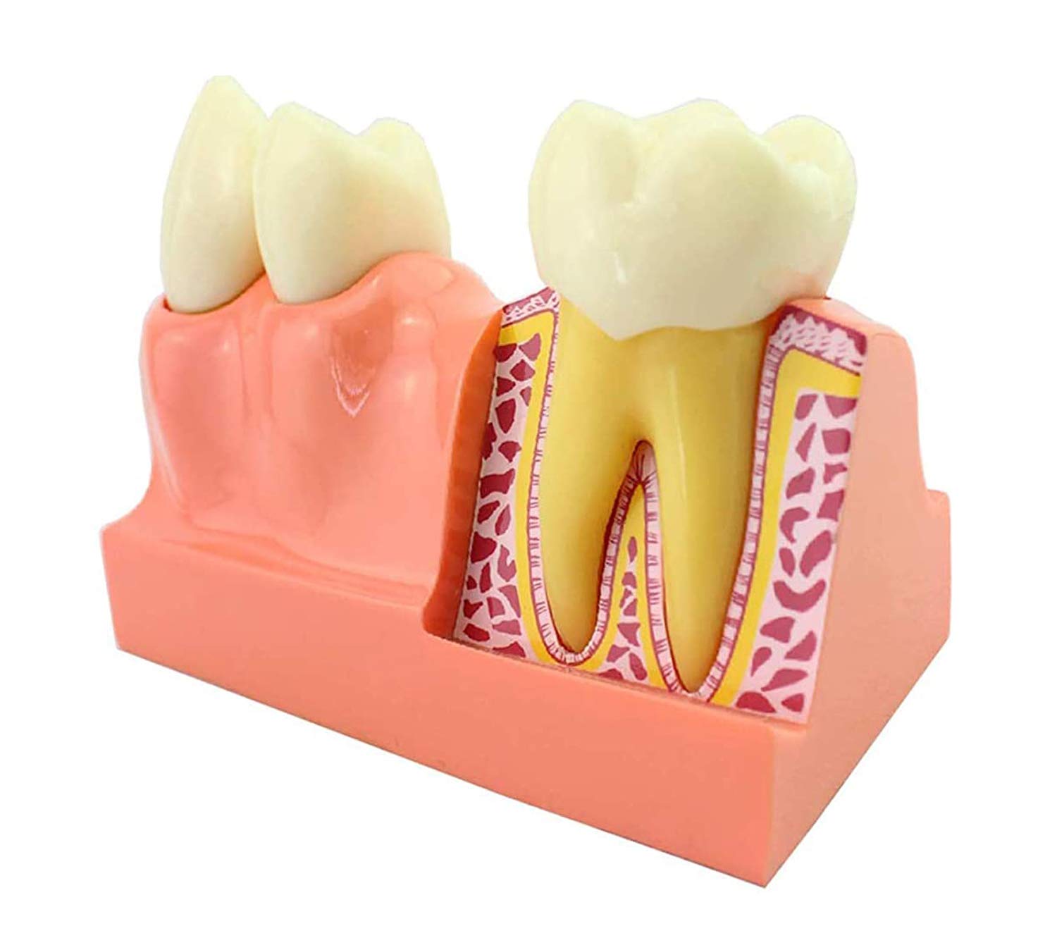 sjdoPulse Teeth Teaching Model - Detachable Stomatology Caries Decomposition Teeth Model - Removable Dental Teeth Study Teaching Model - for Medical Educational Training Aid (A)