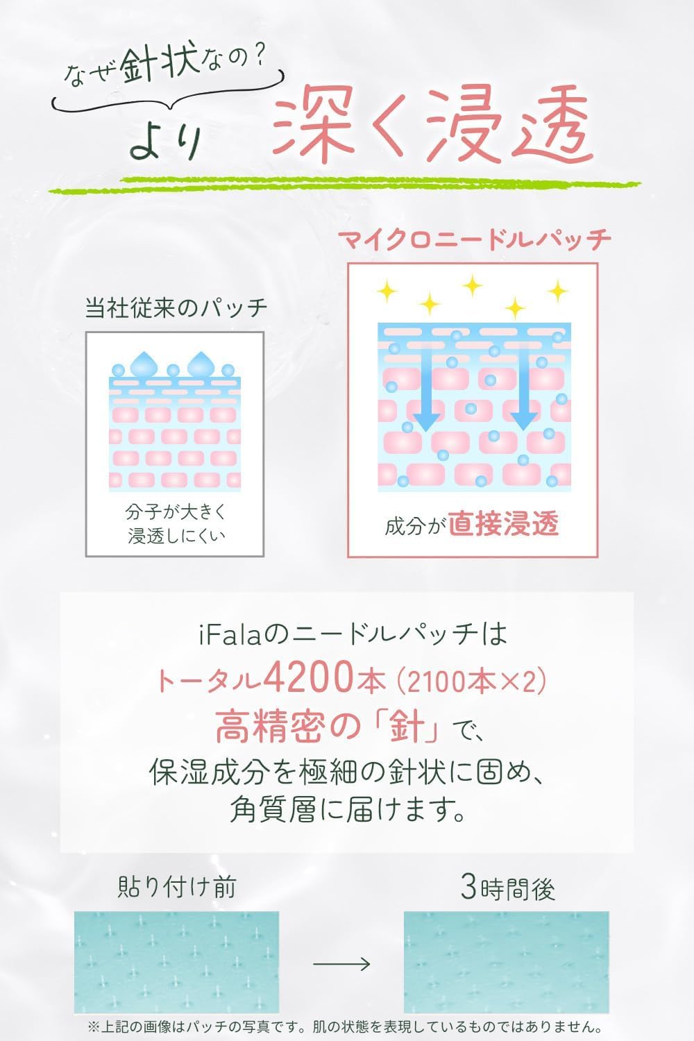 Amazon.co.jp: 目元パック ニードルパッチ ヒアルロン酸パッチ [CICA