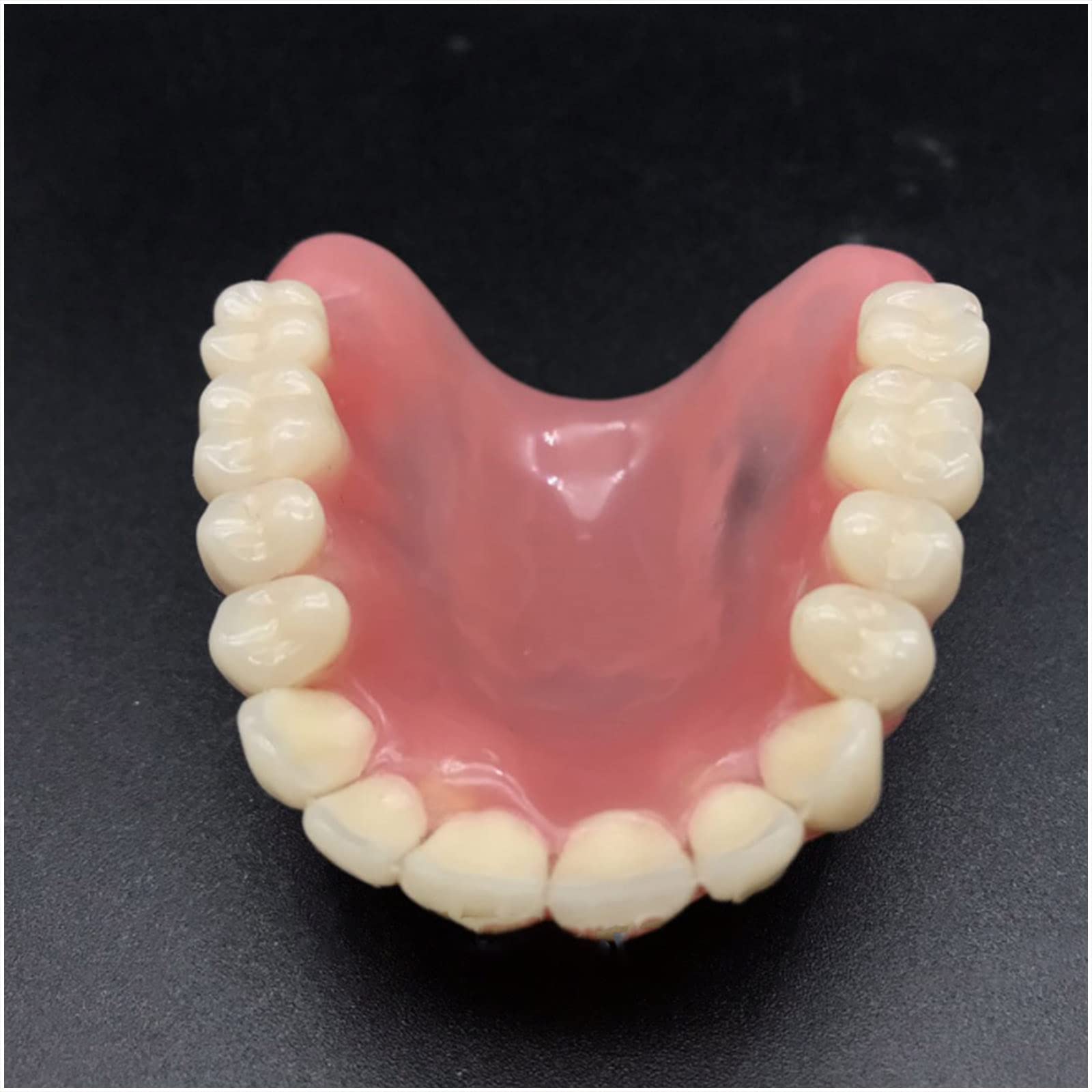 Modello di impianto Dentale - Modello di Protesi dentaria overdenture a 4 impianti - Modello di Denti dentali dimostrativo Trasparente per Studio Modello didatt，Upper Teeth