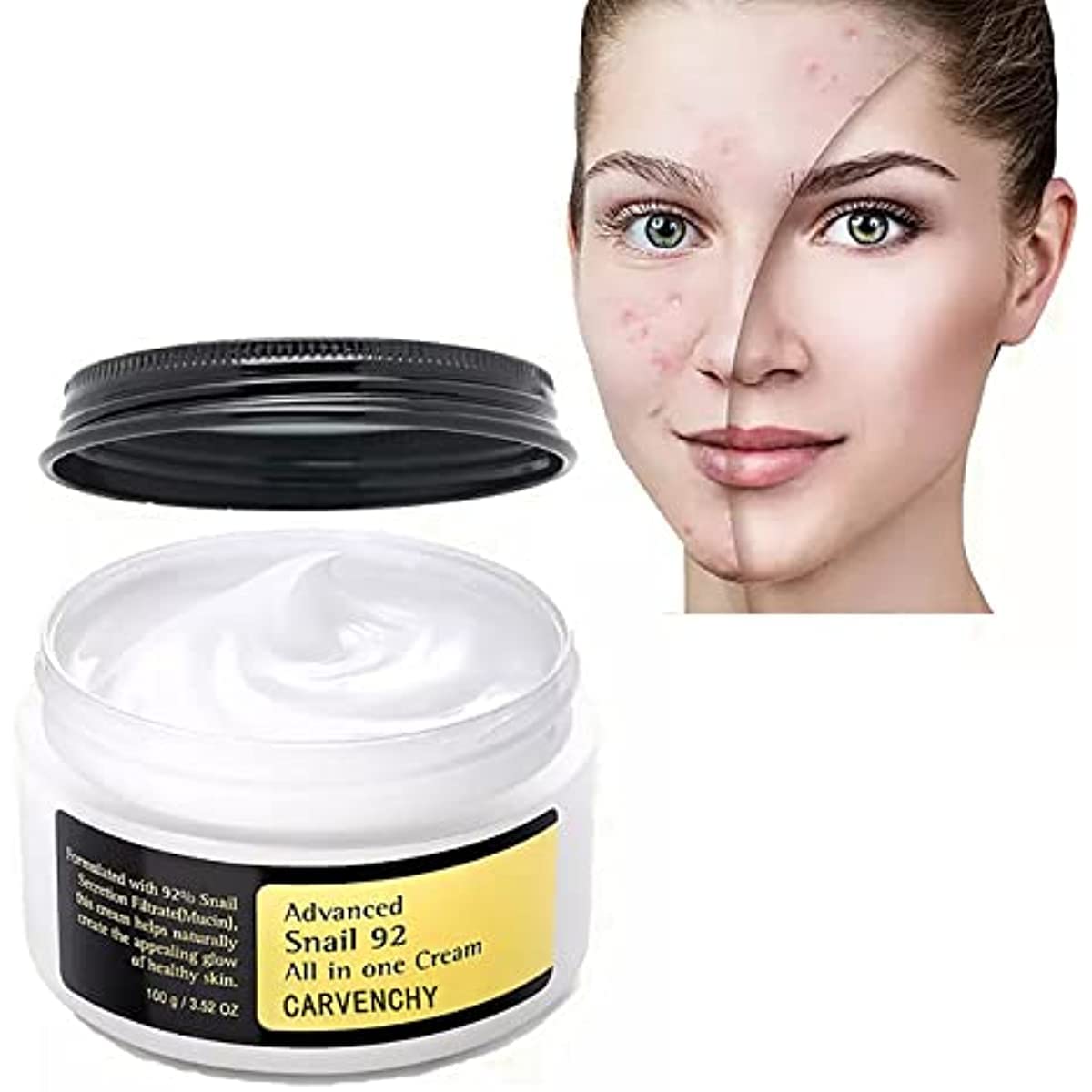 Advanced Snail 92 All in one Cream, Snail Cream for Face Moisturiser Facial Snail Secretion Filtrate 92% Mucin, Natural Skin Care & Deep Hydration, Slime Gel Snail Serum Mask for Acne Scars