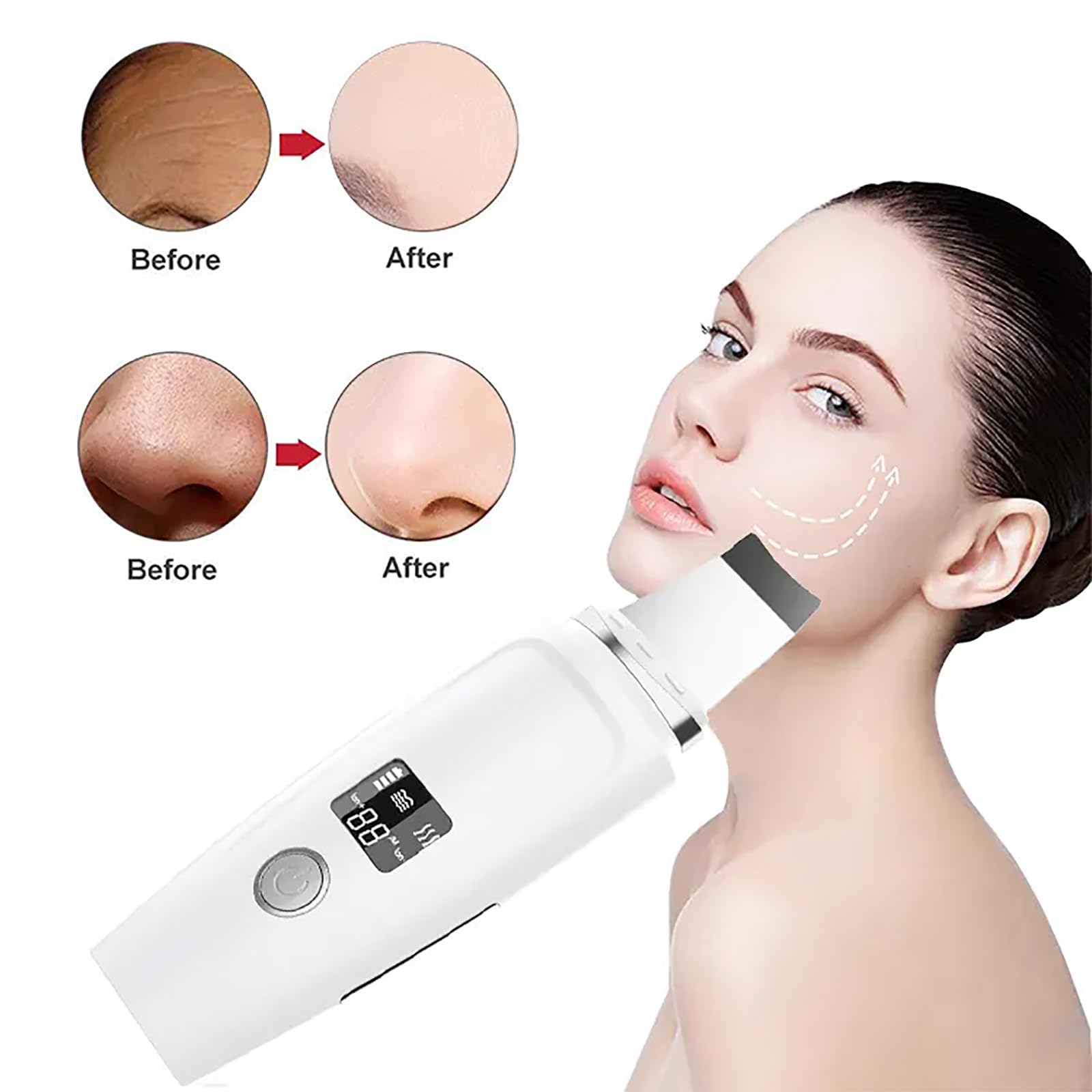 Peeling Ultradźwiękowy, Peeling Do Skóry Twarzy Z Wyświetlaczem LED, 3 Funkcje Ogrzewania I 4 Regulowane Tryby Czyszczenia, Wibracje O Wysokiej Częstotliwości 24000 Razy Na Minutę, Do Domu