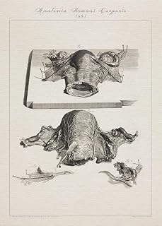 Human anatomy CERVIX FORNIX UTERUS print SRA3 12x18 conqueror laid paper