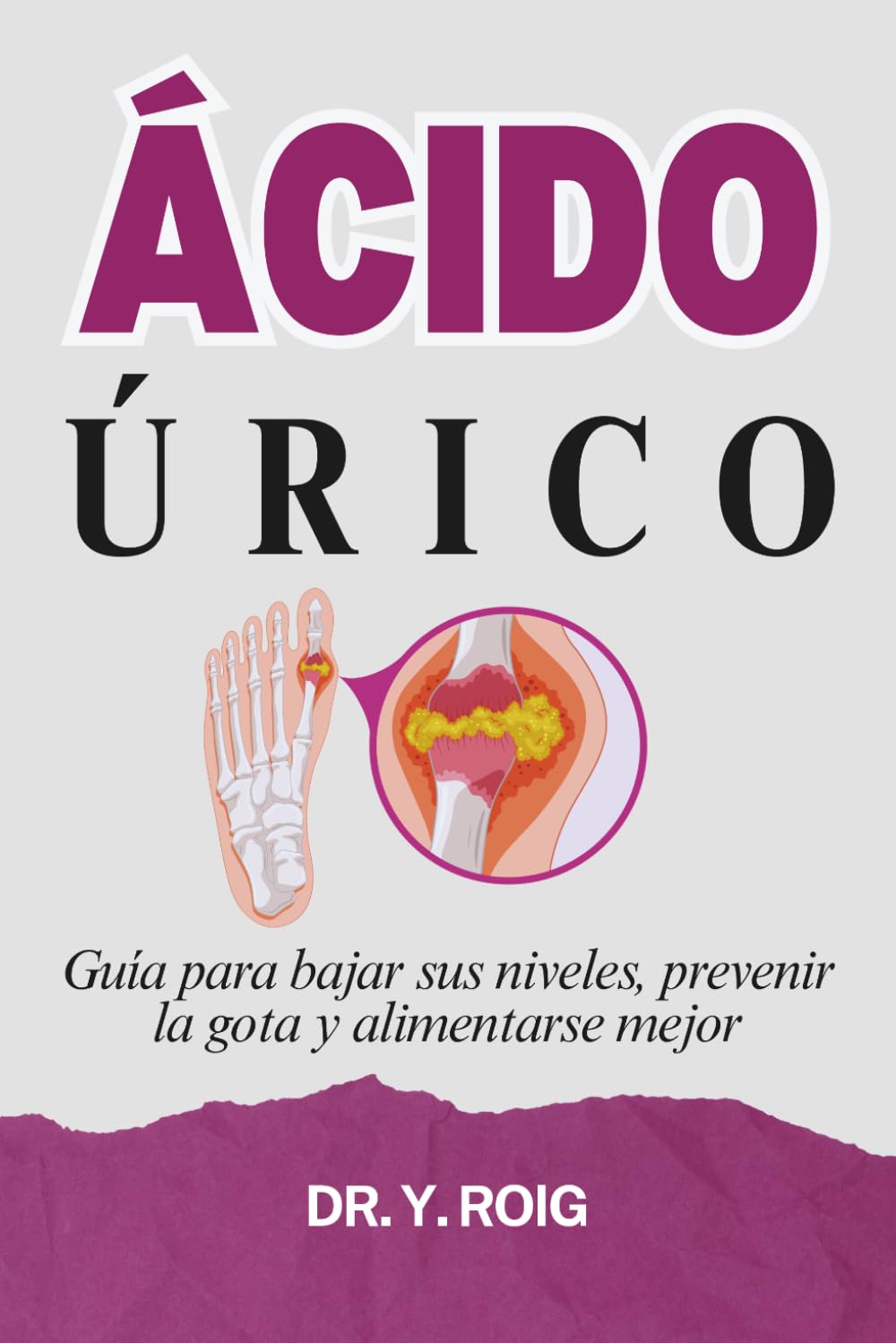 Ácido Úrico: Guía para bajar sus niveles, prevenir la gota y alimentarse mejor