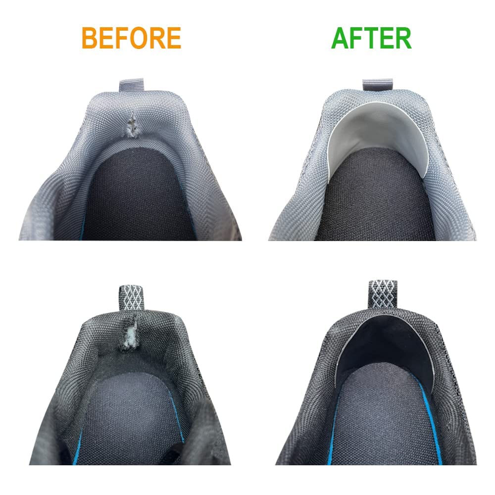 Unikstep 30 Pieces 5 Colors Shoe Repair Patches Kit, Worn Sneaker Upper