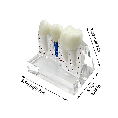 Miniatura 50 de 2 modelos de dientes estándar, modelo dental para adultos, modelo estándar de demostración de Typodont para niños, enseñanza dental, pantalla