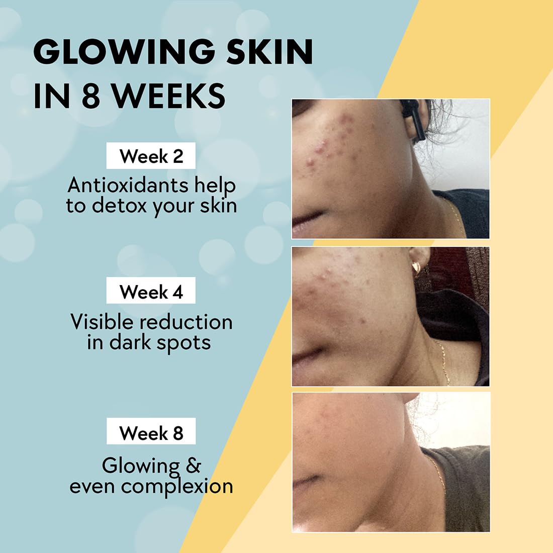 Chicnutrix Glow- 10 Effervesced Tablets | Japanese glutathione and Wit. C | Antioxidant for clear, glowing skin. Chinese free, strawberry-lemon taste Chicnutrix Glow- 10 Effervesced Tablets | Japanese glutathione and Wit. C | Antioxidant for clear, glowing skin. Chinese free, strawberry-lemon taste