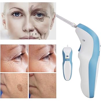 Plasma Pen Skin Tightening Tag Wart Mole Remover Kit Tattoo Dark Spot Freckle Removal Laser Pen Amazon Co Uk Beauty