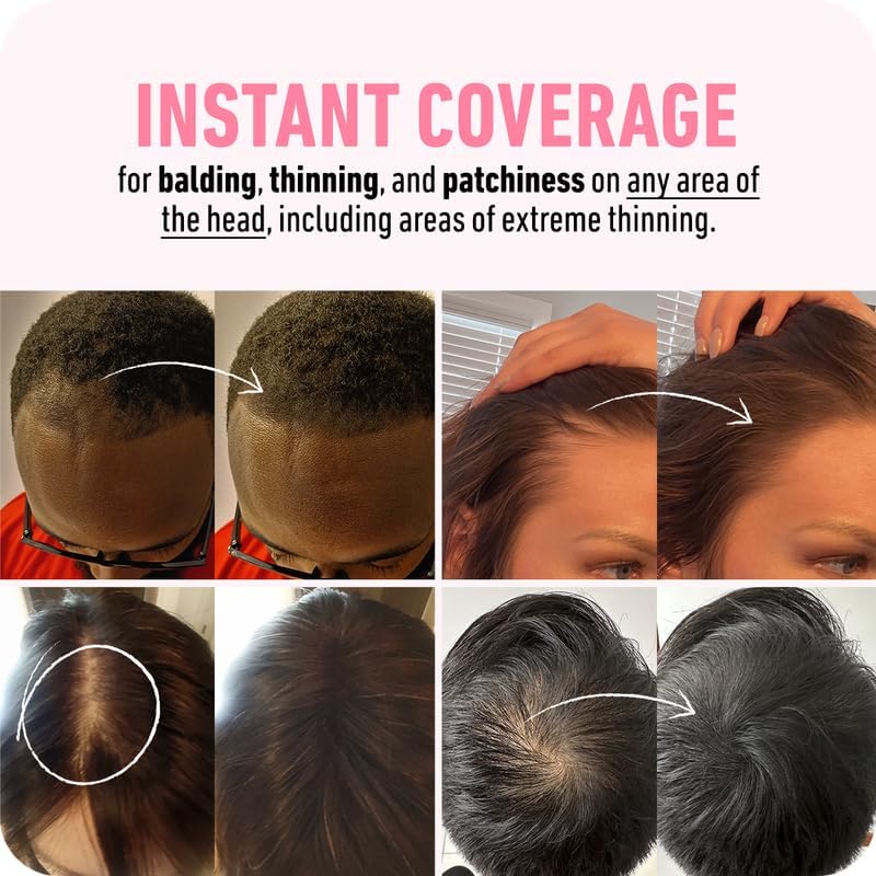 BOLDIFY Hairline Powder (LARGE, 10g), Root Touch Up Hair Color for Gray Coverage - Image 4