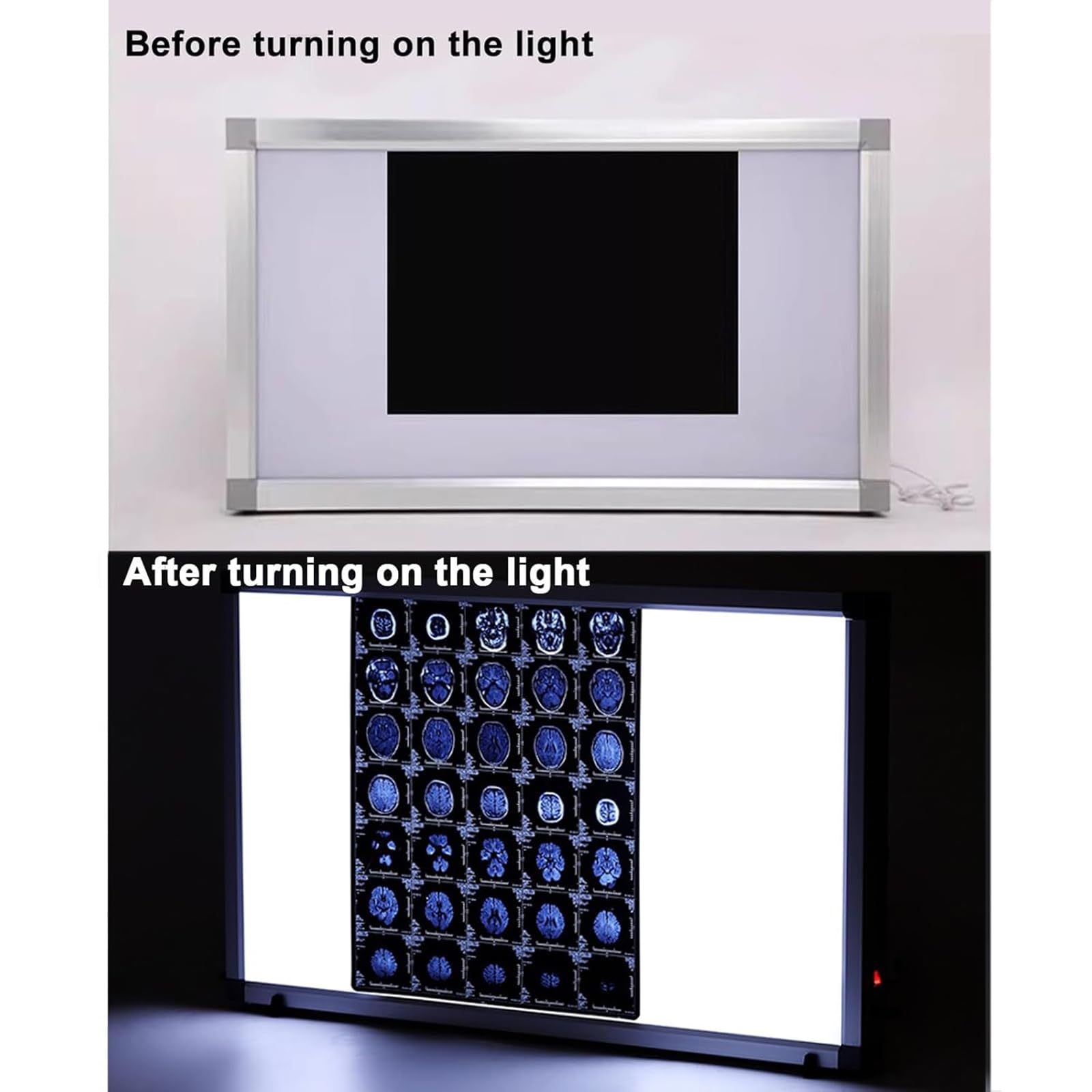 Generico Lettore di Lastre a Raggi X, Scatola Luminosa con Pannello LED per Raggi X con Staffa, per Uso Medico e Dentale, Senza Ombre,44x7x52cm