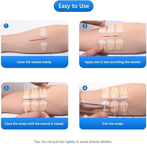 Miniatura 4 de Cierres de heridas de emergencia 10 unidades de dispositivo de cierre de heridas con cremallera, suturas sin dolor, reparación de laceración sin