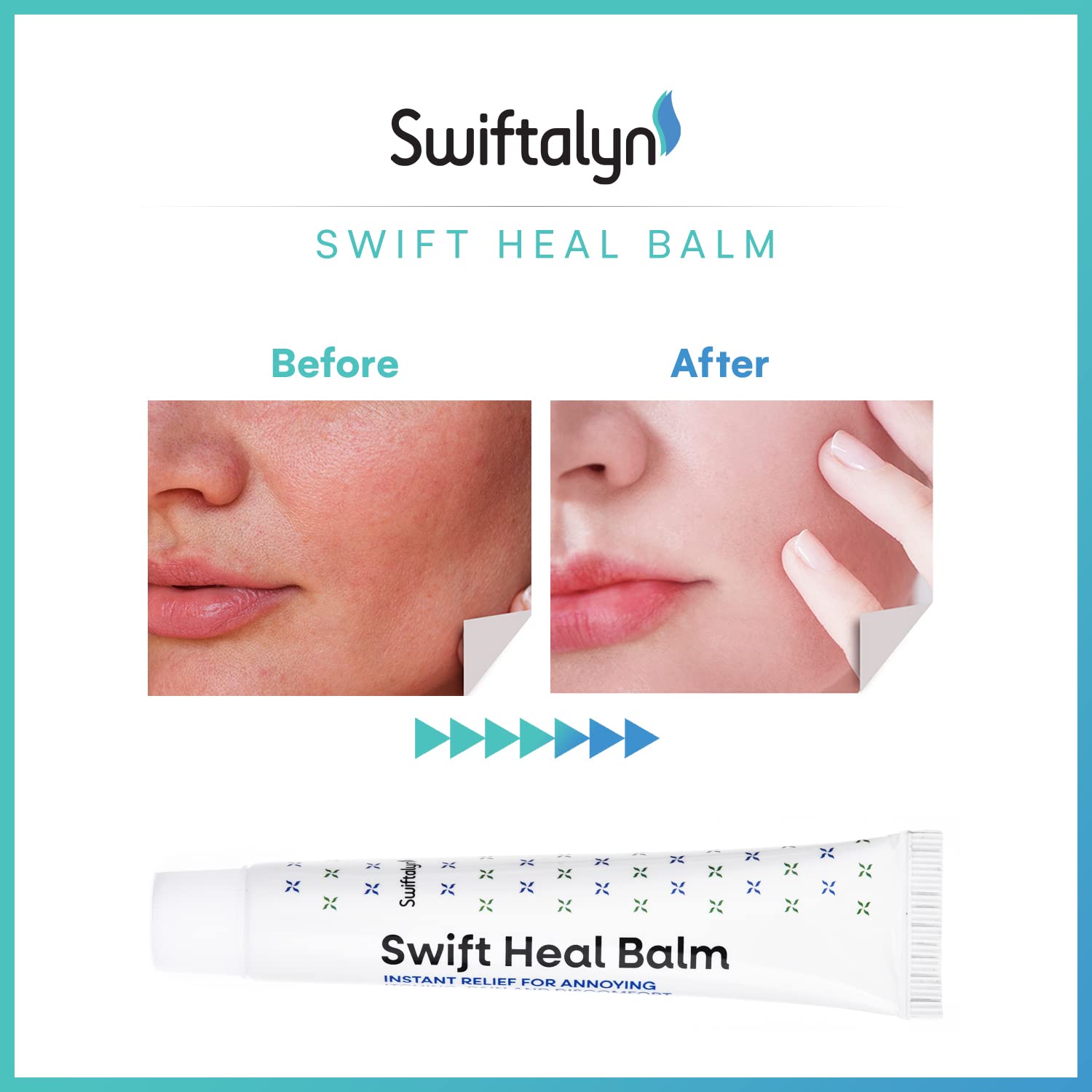 Buy Swiftalyn Swift Heal Balm Dermatitis Eczema Psoriasis Cream Therapy