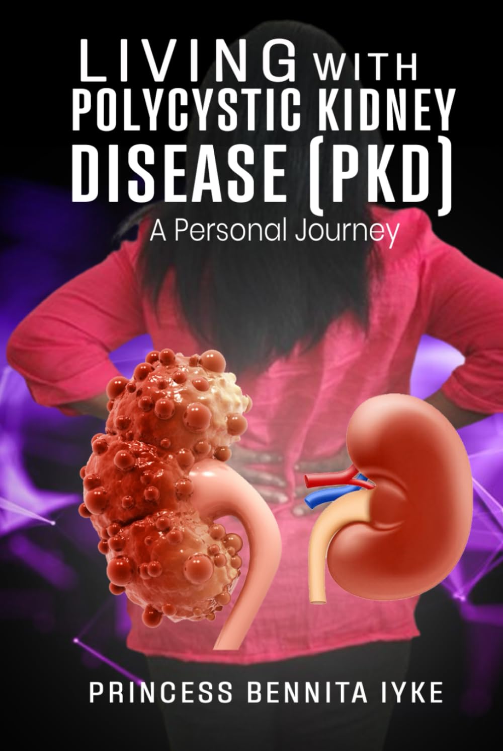 Living with Polycystic Kidney Disease (PKD): A Personal Journey!