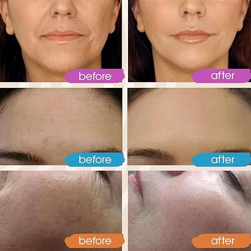 Miniatura 3 de GLEOW Nuevo suero de ácido hialurónico puro 2024 para cara, suero hidratante, suero antienvejecimiento para mujeres, suero facial para piel seca y