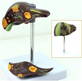 Teaching Model Liver Pathology Model - Human Anatomical Model - Medical Teaching Anatomy Cirrhosis Modeluseful SaiFei