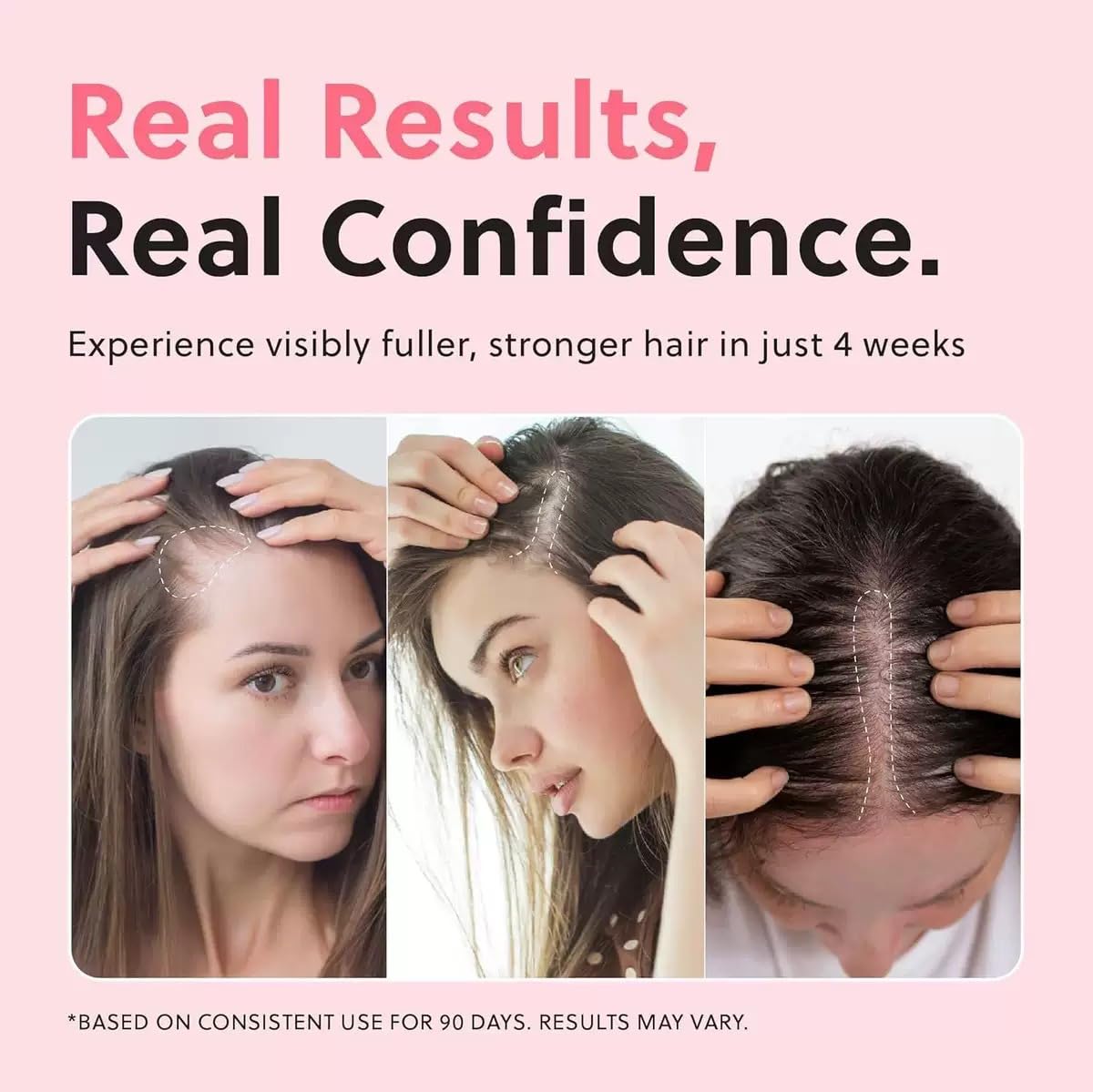 Aceite en spray para el crecimiento del cabello, esencia natural anticaída, refrescante y no graso, previene la caída del cabello, apto para cuero cabelludo seco.