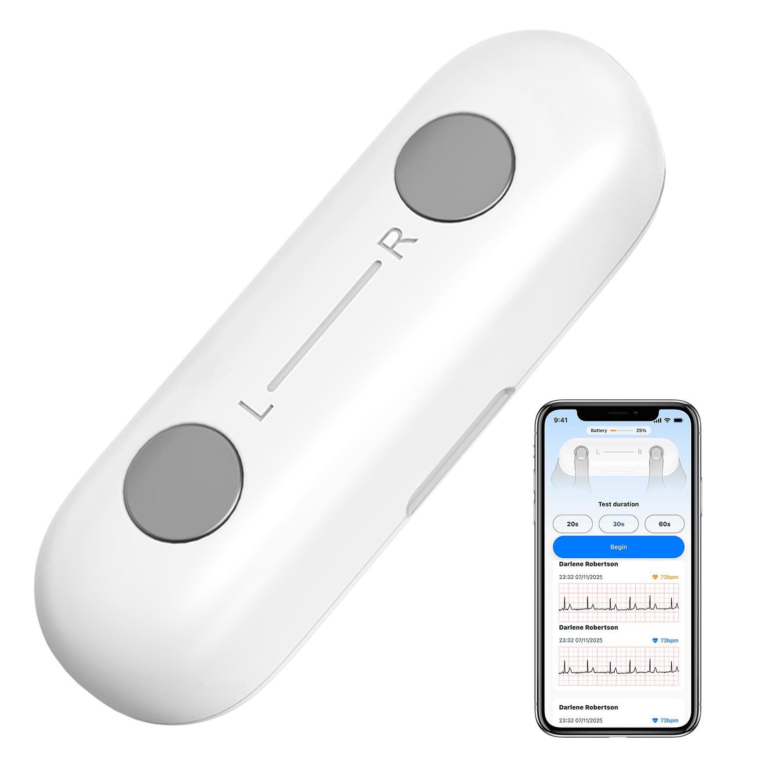 Monerr Portable ECG Monitor | Record and Store One-Lead ECG Signals | Monitor and Display Heart Rate for Home Health Care Use -White