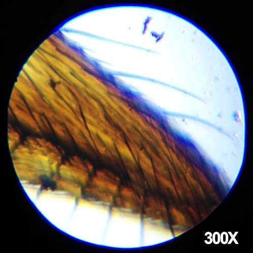 Vista 9 de AmScope Microscopio trinocular compuesto profesional T390B, aumento 40X-2000X, oculares WF10x y WF20x, Brightfield, iluminación halógena