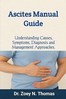 Ascites Manual Guide: Understanding Causes, Symptoms, Diagnosis and Management Approaches