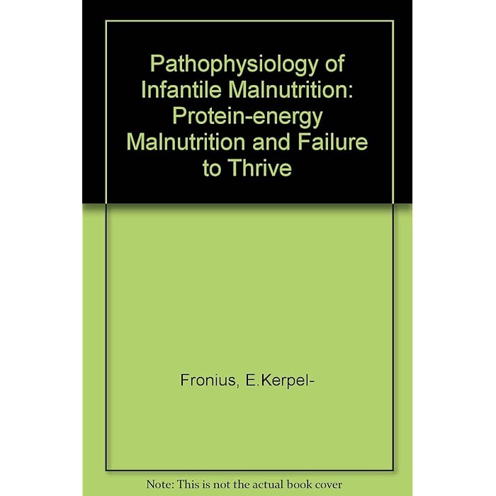 Buy Pathophysiology of Infantile Malnutrition Proteinenergy
