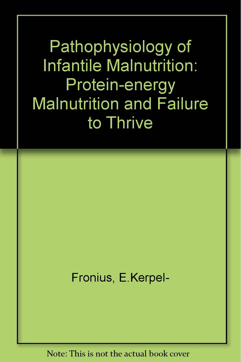 Pathophysiology Of Infantile Malnutrition Protein Energy Malnutrition ...