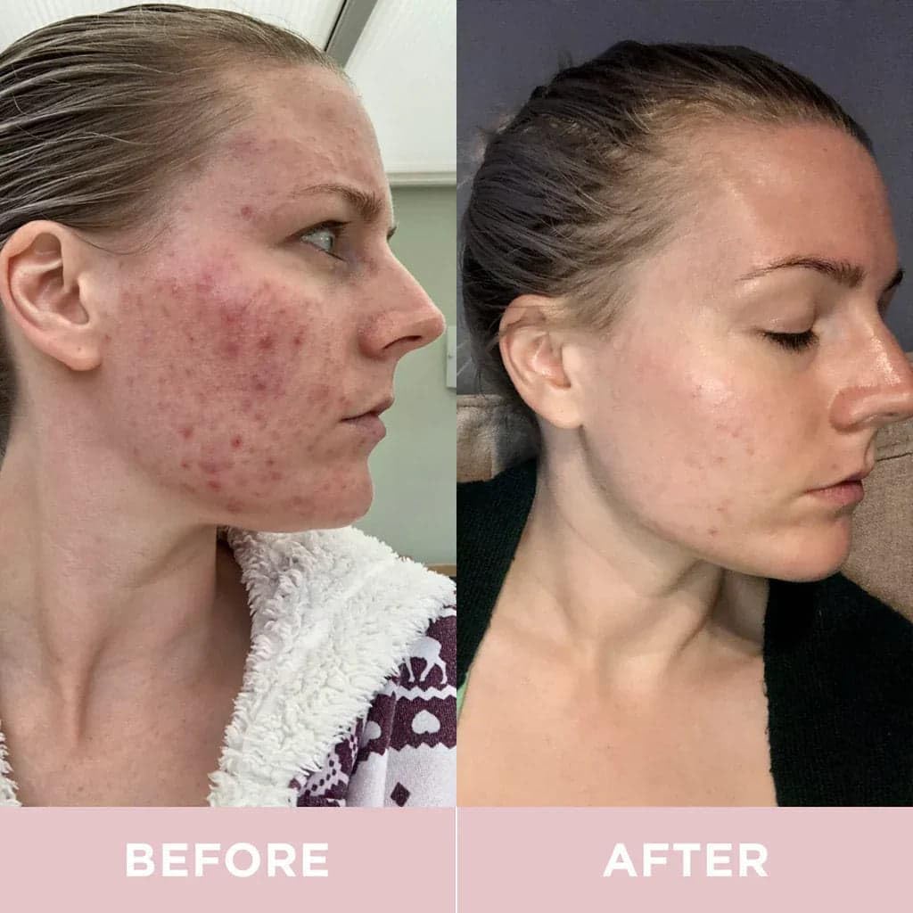 Revive Collagen Premium — Hydrolyzed Marine Collagen Drink for Women, 8,500MG, with Hyaluronic Acid, Aloe Vera Juice, Revive Skin Health, Hydration, Hair & Skin, Lemon & Lime Flavour — 14 Sachets - Image 4