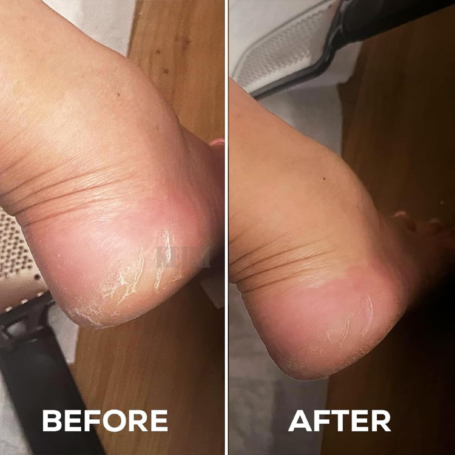 ELUYANI Foot Peeling Mask for Dead Skin Removal β Natural Exfoliating Foot Mask for Dry Feet, Calluses & Cracked Heels (levender foot mask) (PACK OF 2) 4