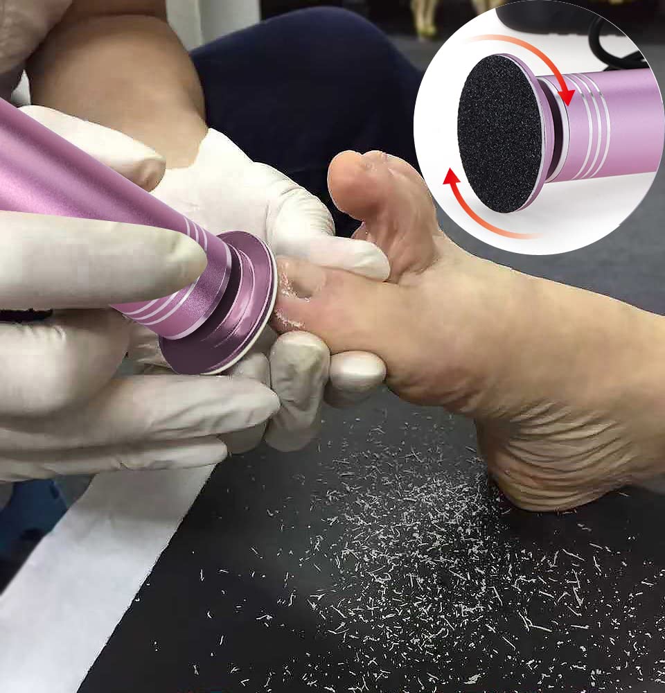 Removedor de callos eléctrico de velocidad ajustable, lima de pedicura profesional para pies con limas de pies intercambiables para pieles muertas y duras y agrietadas, con 60 almohadillas de lijado