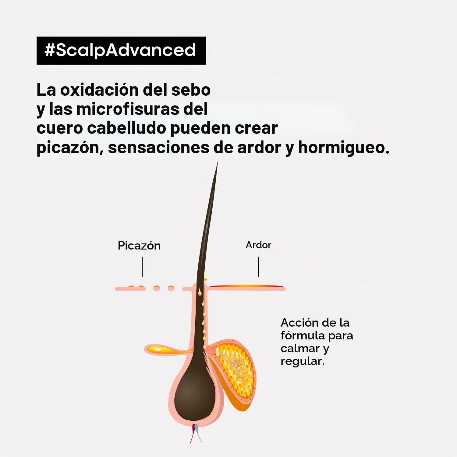 L’Oréal Professionnel, Champú Anti Malestar Enriquecido con Activos Dermatológicos para Cuero Cabelludo Sensible, Scalp Advanced, 500 ml (Paquete de 2)