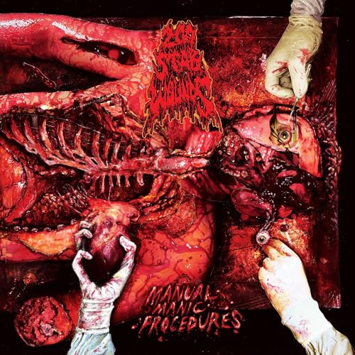 Manual Manic Procedures (輸入盤) [Analog]