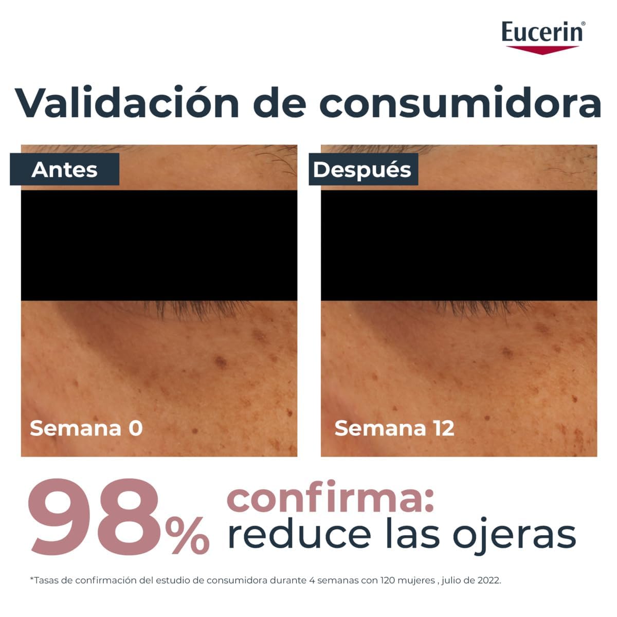 Eucerin Anti-Pigment Contorno de Ojos iluminador (15 ml), crema antiojeras para una mirada radiante, crema con Ácido Hialurónico para ojeras marrones y azuladas